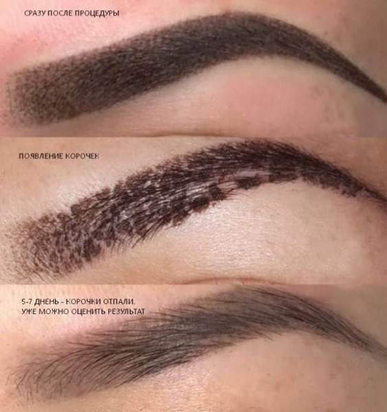 Époussetage poudreux des sourcils. Qu'est-ce que c'est, comment est-ce fait, le prix du maquillage permanent, du microblading, du tatouage. Commentaires