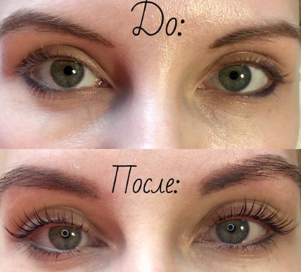 Botox ou lamination des cils: qu'est-ce qui est mieux, qu'est-ce que c'est, en quoi est-ce différent?