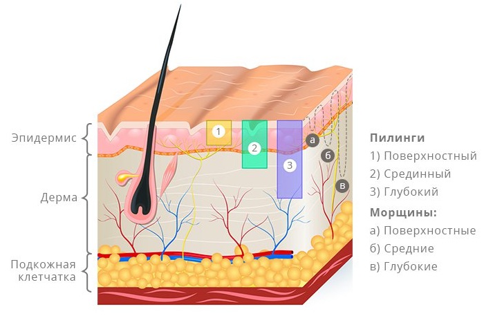 Peeling Jessner. Qu'est-ce que c'est, comment est-ce fait, garderie, critiques