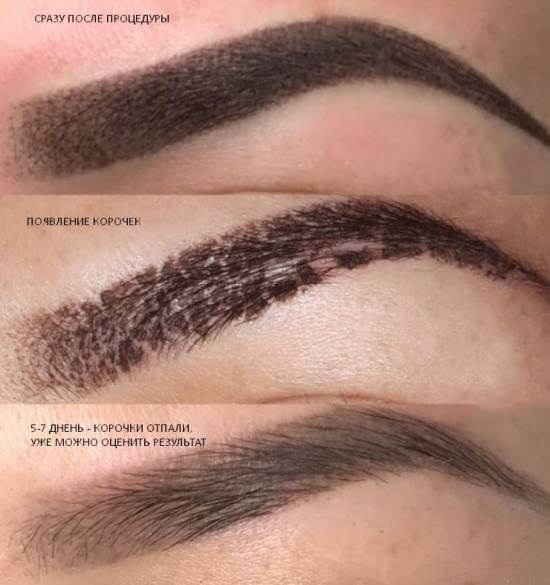 Maquillage permanent des sourcils, saupoudrage de poudre. Photos avant et après, combien de temps, guérison