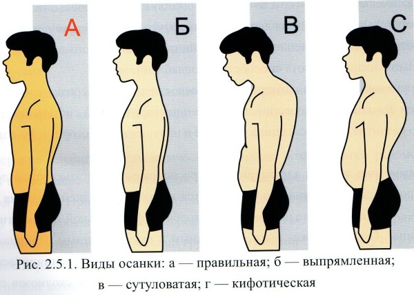 Exercices pour une posture droite au gymnase et à la maison