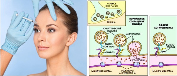 Raffinerx en cosmétologie. Efficacité, effets secondaires de l'utilisation, avis des cosmétologues