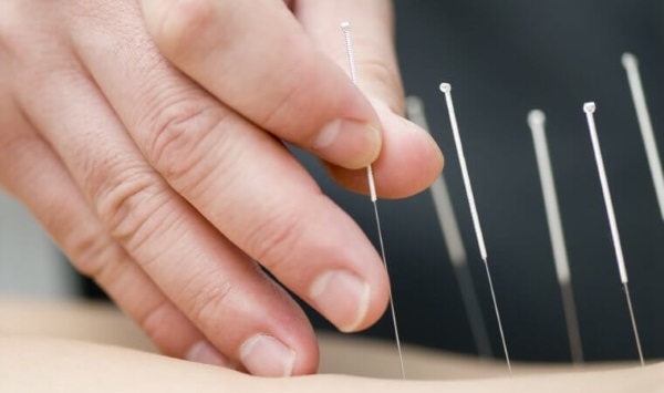 Acupuncture pour perdre du poids. Comment cela se fait dans l'oreille, sur le corps, les avantages et les inconvénients de l'acupuncture, des critiques