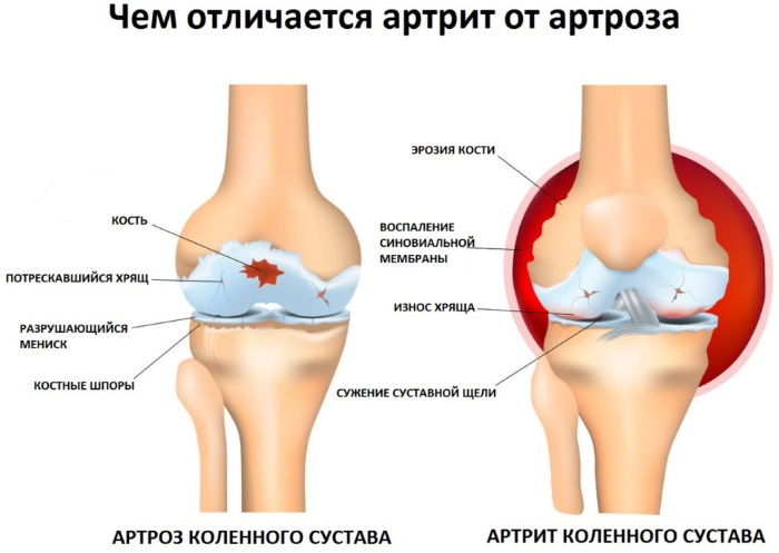 Le muscle le plus large du dos chez la femme. Structure, fonctions, exercices à la maison, au gymnase