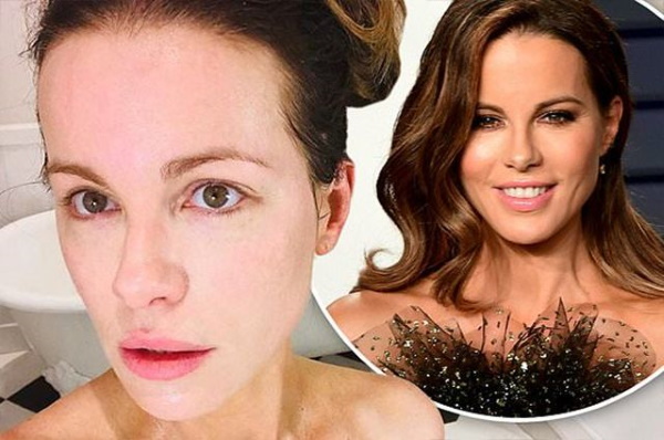 Kate Beckinsale. Photos avant et après la chirurgie plastique, chaude en maillot de bain, sans maquillage, taille, poids, biographie