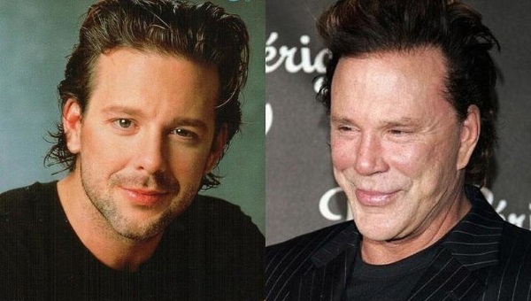 Mickey Rourke. Avant et après la chirurgie plastique, la chirurgie, la photo de la jeunesse, maintenant, la biographie, la vie personnelle