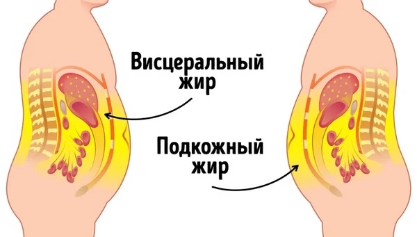 Graisse abdominale sous-cutanée. Comment s'en débarrasser. Comment le pourcentage est calculé, pilules, régime, injections, exercices