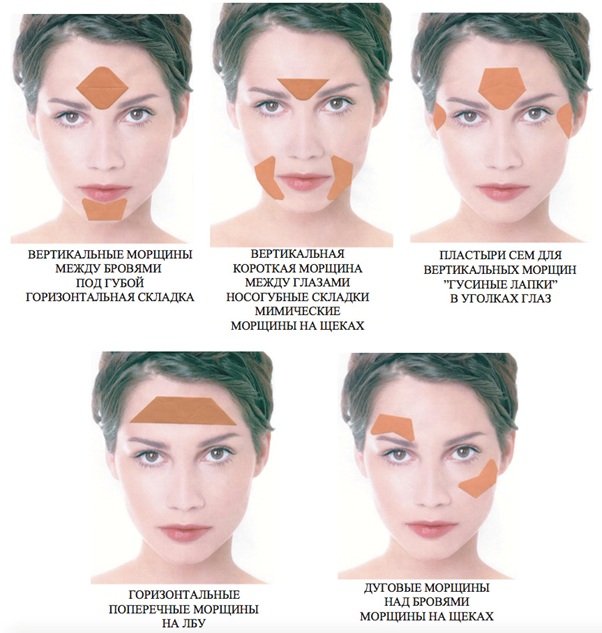 Comment coller correctement des bandes sur votre visage. Taping pour les rides, les poches sous les yeux. Une photo