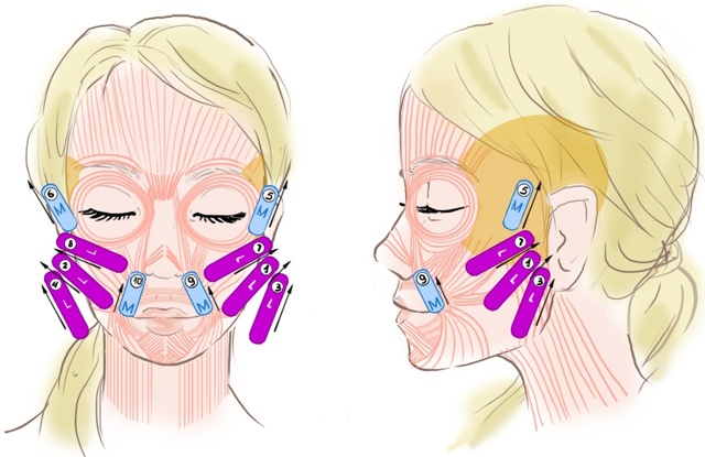 Comment coller correctement des bandes sur votre visage. Taping pour les rides, les poches sous les yeux. Une photo