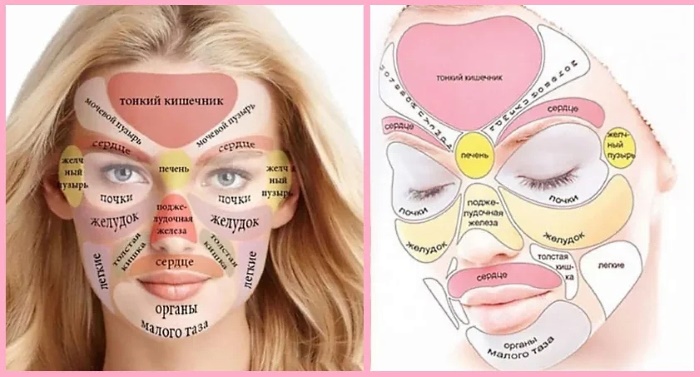 Carte de l'acné sur le visage des femmes, le cou, le corps. Que signifient les raisons par zones, organes