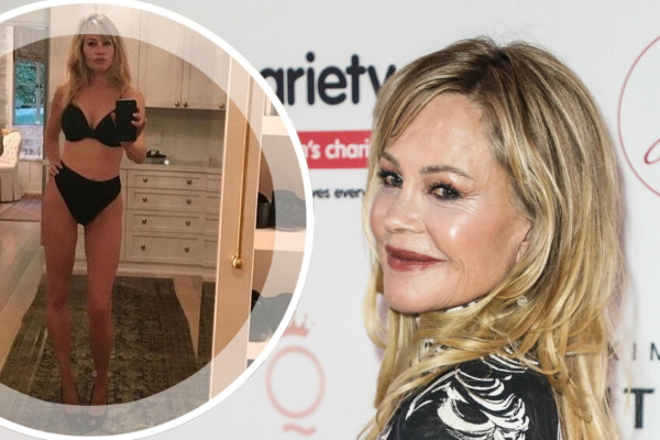 Melanie Griffith. Photos dans sa jeunesse et maintenant, avant et après la chirurgie plastique, biographie