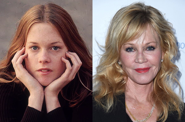 Melanie Griffith. Photos dans sa jeunesse et maintenant, avant et après la chirurgie plastique, biographie