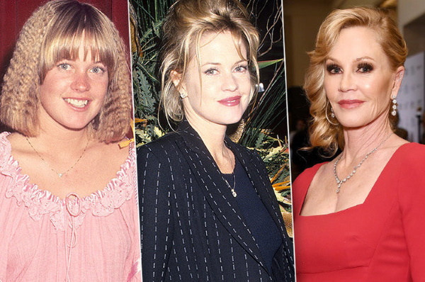 Melanie Griffith. Photos dans sa jeunesse et maintenant, avant et après la chirurgie plastique, biographie