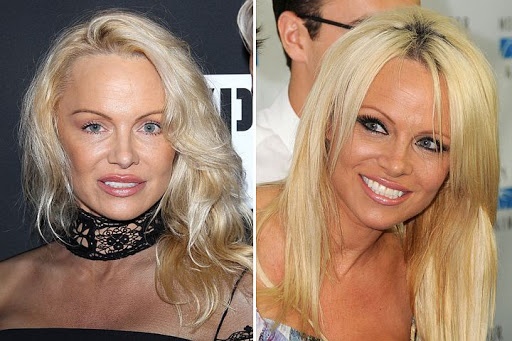 Pamela Anderson. Photos dans sa jeunesse, maintenant, Playboy, avant et après la chirurgie plastique, biographie, vie personnelle