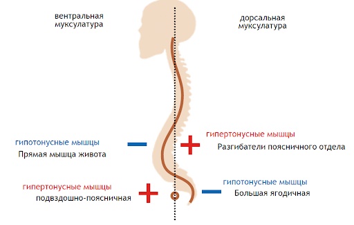 Le muscle iliopsoas. Exercices de renforcement, étirements, comment pomper