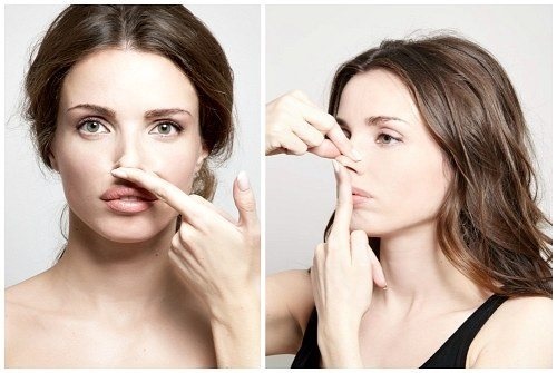 Une bosse sur le nez de la fille. Beau ou pas, comment enlever sans chirurgie, rhinoplastie