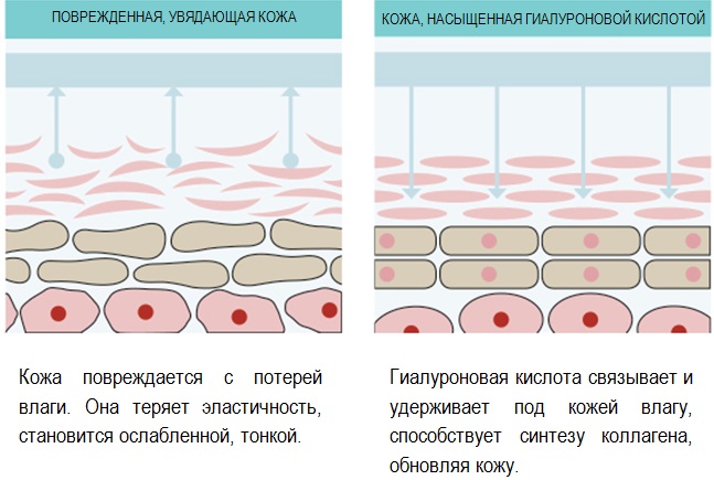 Analogues de Botox pour le visage de la production russe, France, Corée. Xeomin, Dysport, Relatox