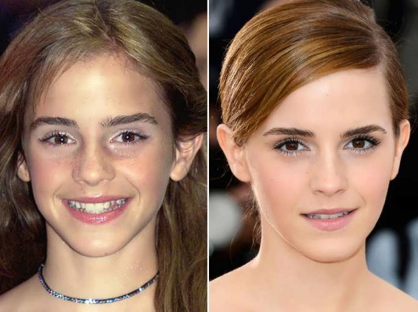 Emma Watson. Photos chaudes, candide en maillot de bain, figure, biographie, vie personnelle