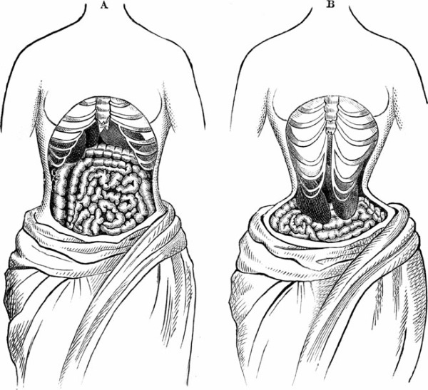 Corset amincissant pour le ventre et les côtés pour femme. Prix, avis