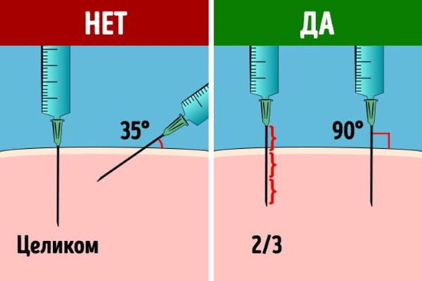 Nicotine (acide nicotinique) en injections. Instructions, indications d'utilisation, déroulement du traitement