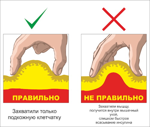 Nicotine (acide nicotinique) en injections.Instructions, indications d'utilisation, déroulement du traitement