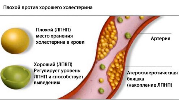 Nicotine (acide nicotinique) en injections. Instructions, indications d'utilisation, déroulement du traitement