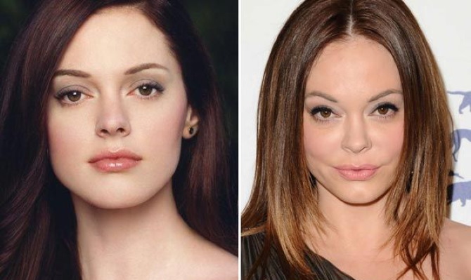 Rose McGowan. Photos divulguées, avant et après l'accident, volées, biographie, vie personnelle