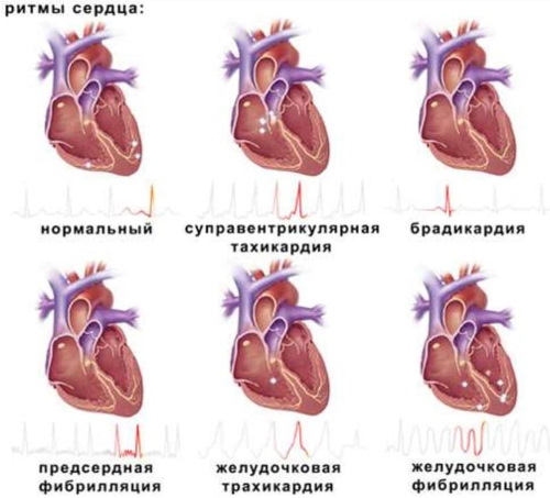 Како уклонити двоструку браду. Козметологија без операције: ињекције, нити, пунила, вежбе, ревитоницс, РФ лифтинг, липолитици, Дарсонвал, теипс и још много тога