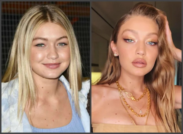 Gigi Hadid. Photo en maillot de bain, avant et après chirurgie plastique, perte de poids