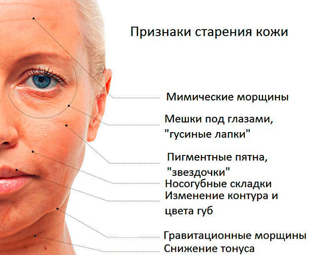 Comment se débarrasser des rides sous les yeux. Cosmétologie