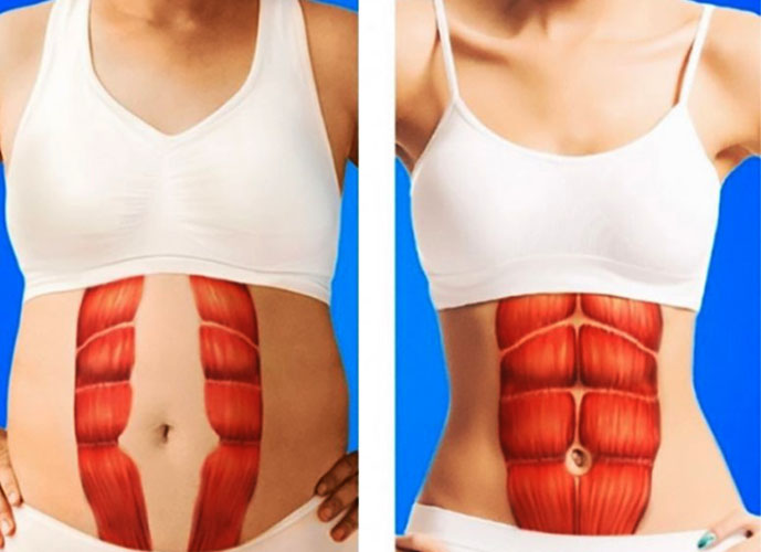 Muscle abdominal transversal. Anatomie, fonction, entraînement des abdominaux