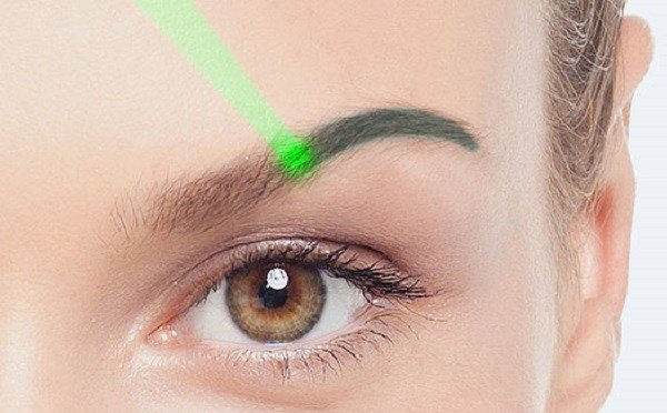 Élimination au laser du maquillage permanent (tatouage) des sourcils, des lèvres, des paupières