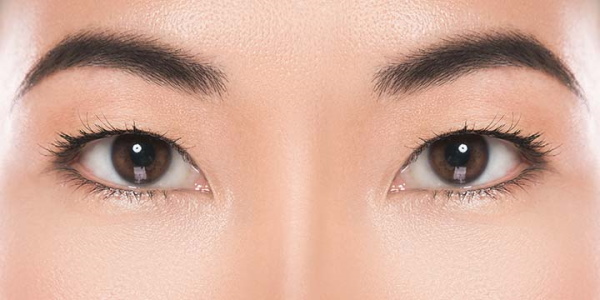 Les filles ont de petits yeux. Comment augmenter le prix de la chirurgie plastique