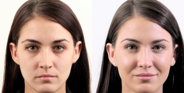 Les pommettes sont l'endroit sur le visage, la photo, l'anatomie, comment faire