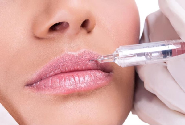 Les filles ont des lèvres fines. Comment augmenter avec de l'acide hyaluronique, un remplisseur, du botox