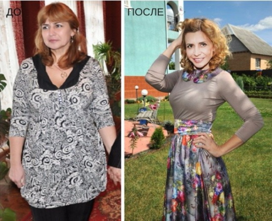 Irina Agibalova. Photos avant et après la chirurgie, perte de poids